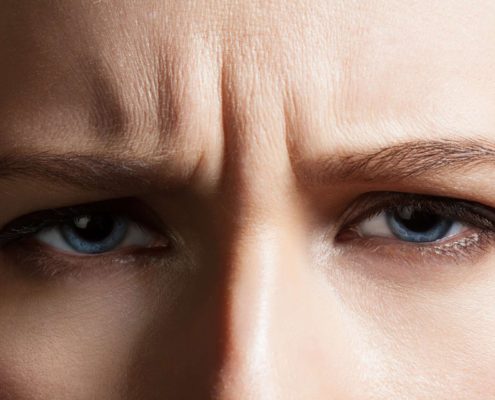 Angry face of a young woman with facial wrinkles closeup