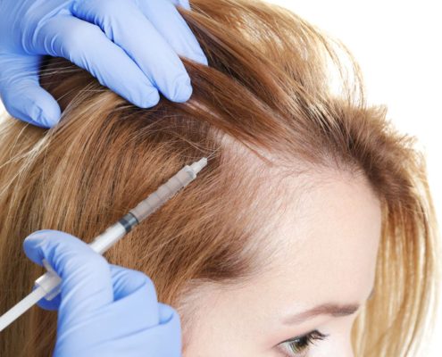 Young woman with hair loss problem receiving injection on white background, closeup